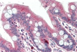 DTX2 Antibody, Novus Biologicals 0.1mg; Unlabeled:Antibodies, Polyclonal